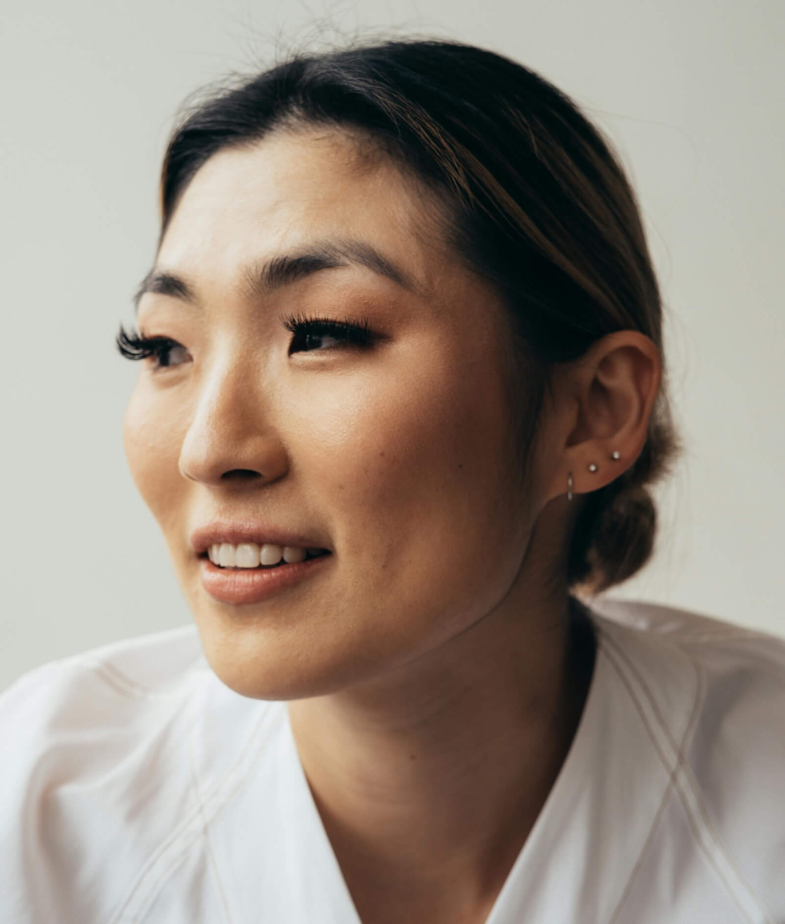cheek implant overview