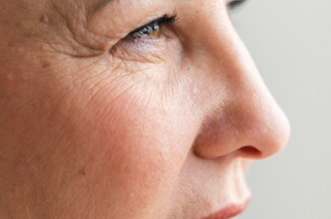 eyelid-surgery eyelid surgery