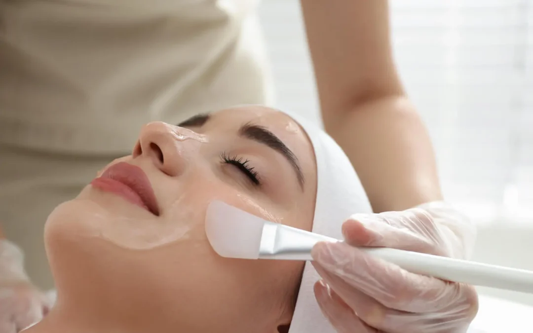Advantages of Using Chemical Peels for Brown Spots: A Clearer, Brighter Complexion Starts Here