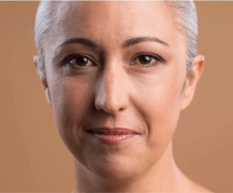 ethnic-rhinoplasty ethnic rhinoplasty