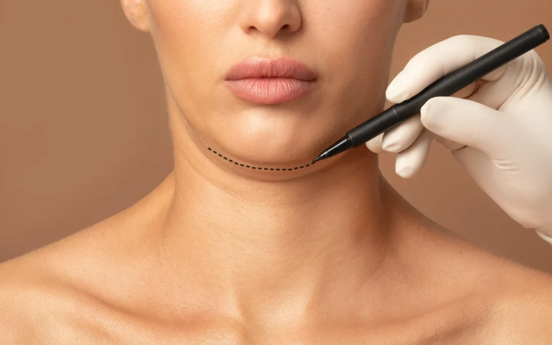 The Double Chin: Genetics, Aging, and Plastic Surgery Solutions