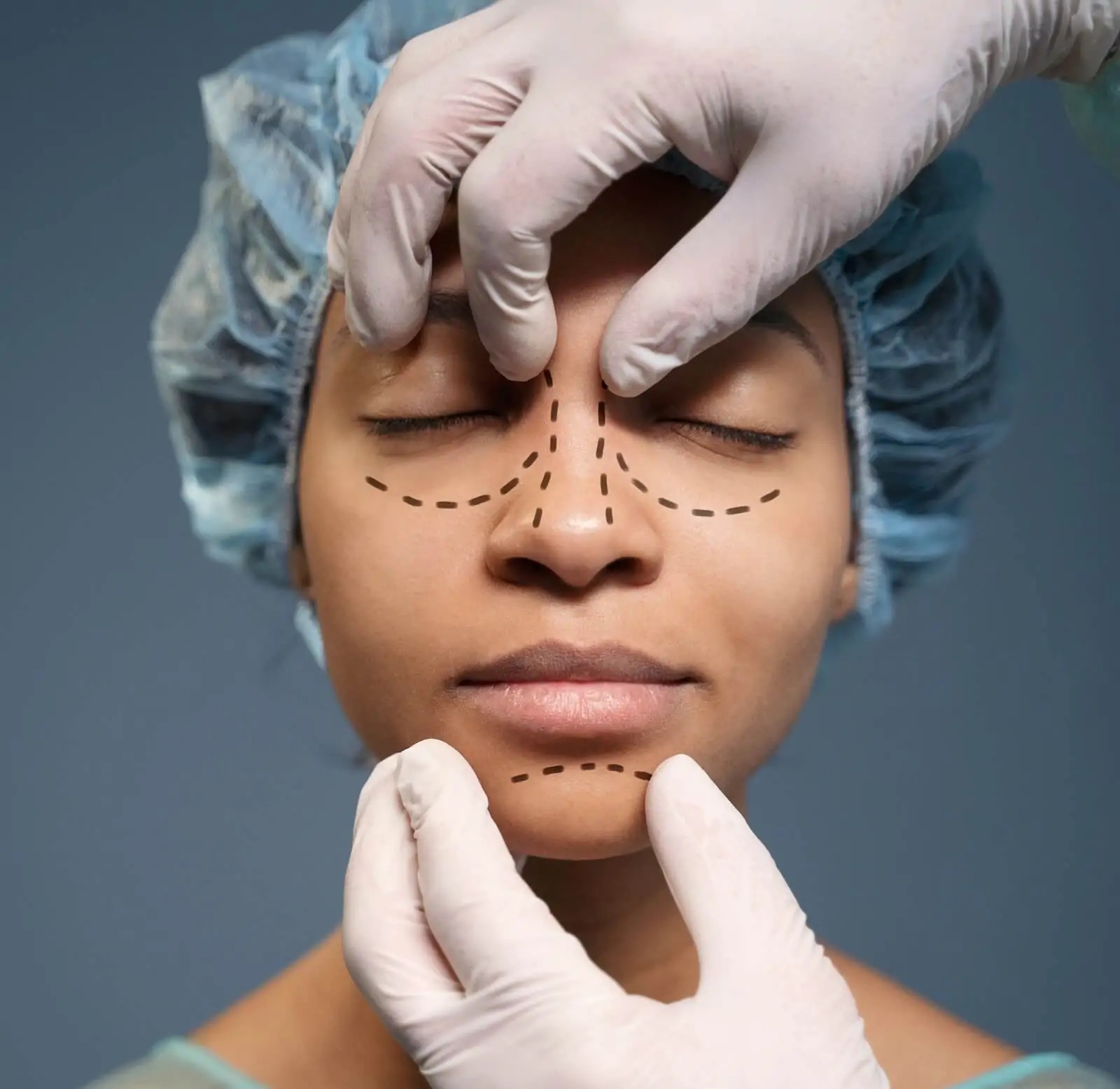 ultrasonic-rhinoplasty ultrasonic rhinoplasty